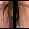 Skin Tightening - NEW Treatments! offer Professional Services