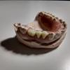 Affordable low cost Same day Denture repair service